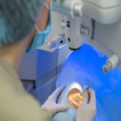 Creating The Micro Incision